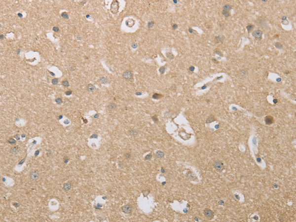 Anti-P2RY11 Rabbit Polyclonal Antibody