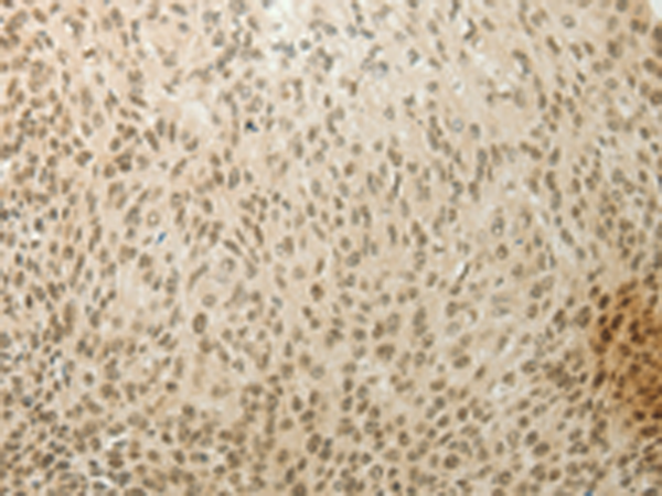 Anti-MYSM1 Rabbit Polyclonal Antibody