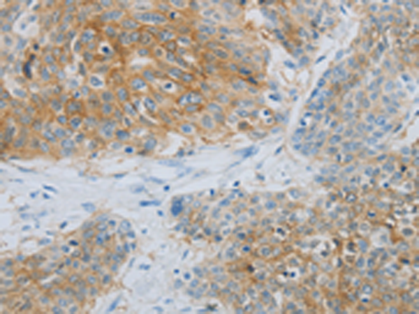 Anti-NDRG1 Rabbit Polyclonal Antibody