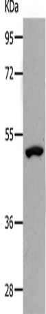 Anti-NDRG1 Rabbit Polyclonal Antibody