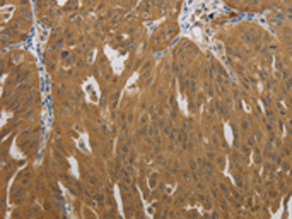 Anti-NIT2 Rabbit Polyclonal Antibody
