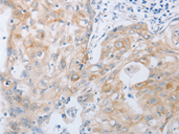 Anti-Substance K Receptor Rabbit Polyclonal Antibody