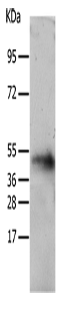 Anti-Substance K Receptor Rabbit Polyclonal Antibody