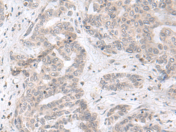 Anti-Notch2 Rabbit Polyclonal Antibody