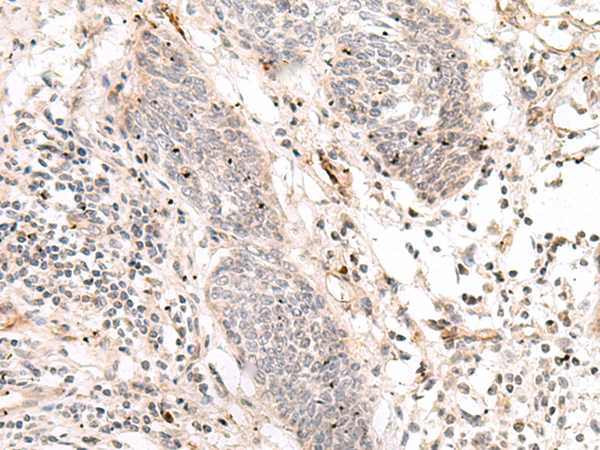 Anti-Notch3 Rabbit Polyclonal Antibody