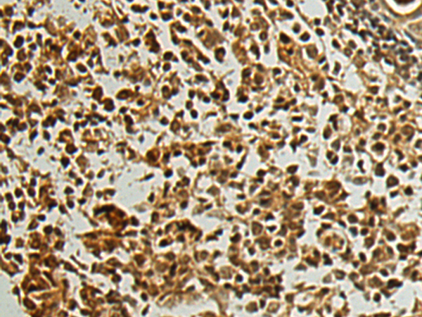 Anti-PALB2 Rabbit Polyclonal Antibody
