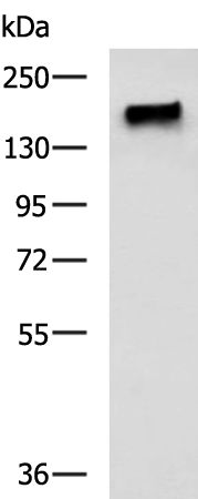 Anti-PALB2 Rabbit Polyclonal Antibody
