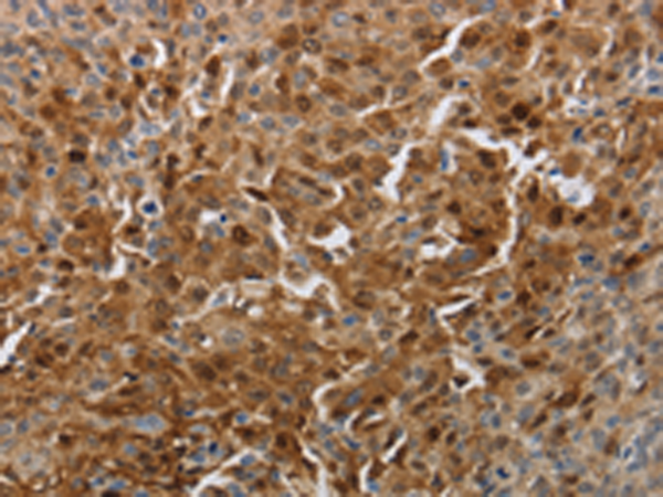 Anti-PDCD2 Rabbit Polyclonal Antibody