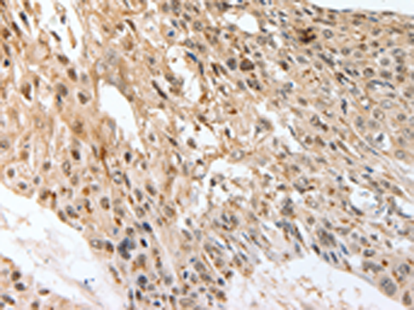 Anti-SLC1A7 Rabbit Polyclonal Antibody