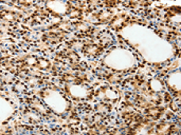 Anti-SPATA20 Rabbit Polyclonal Antibody