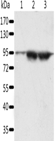 Anti-SPATA20 Rabbit Polyclonal Antibody