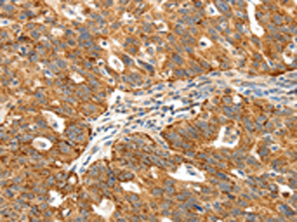 Anti-SSTR1 Rabbit Polyclonal Antibody