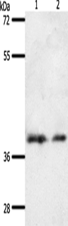 Anti-SSTR1 Rabbit Polyclonal Antibody