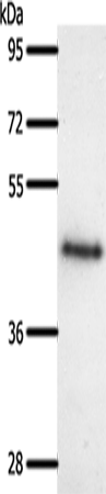 Anti-Somatostatin Receptor 5 Rabbit Polyclonal Antibody
