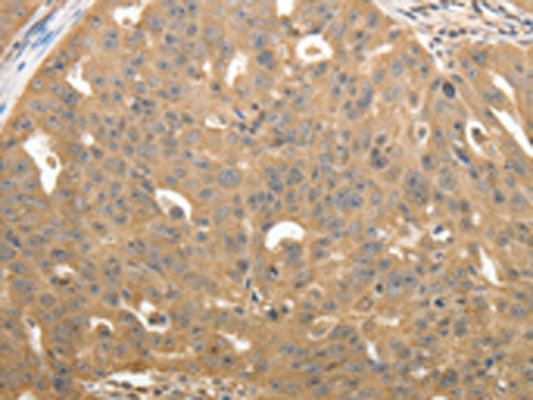 Anti-Syntaxin 1A Rabbit Polyclonal Antibody