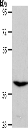 Anti-S1PR4 Rabbit Polyclonal Antibody