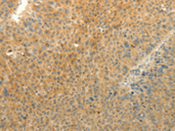Anti-LPAR3 Rabbit Polyclonal Antibody