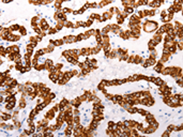 Anti-ABCA4 Rabbit Polyclonal Antibody