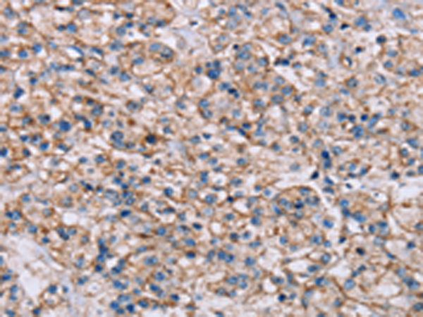 Anti-ADAM12 Rabbit Polyclonal Antibody