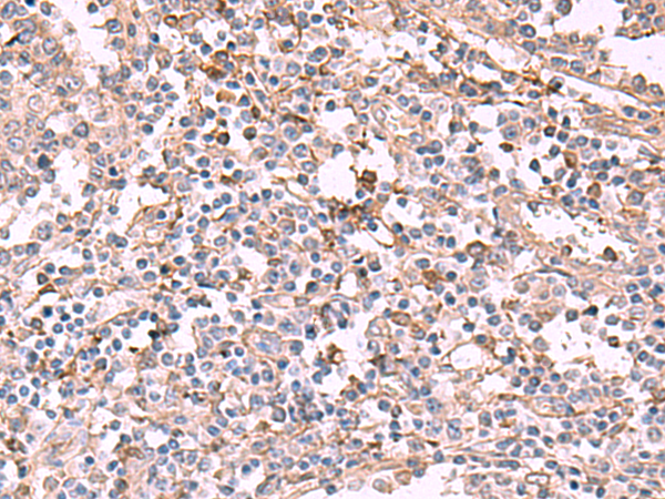 Anti-ADH1B Rabbit Polyclonal Antibody