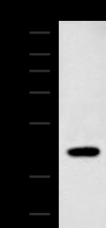 Anti-ADH1B Rabbit Polyclonal Antibody