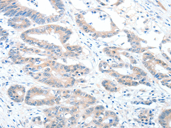 Anti-ALDH1A2 Rabbit Polyclonal Antibody