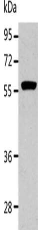 Anti-ALDH1A2 Rabbit Polyclonal Antibody