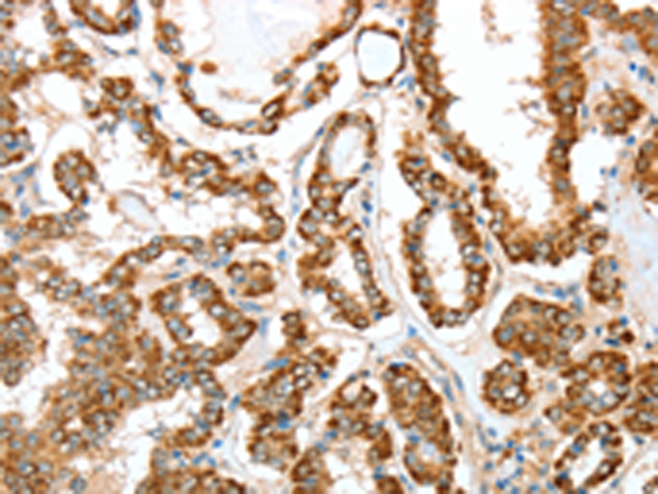 Anti-ALDH9A1 Rabbit Polyclonal Antibody