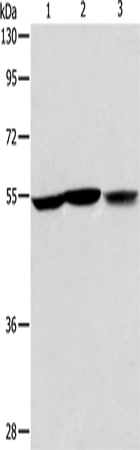 Anti-ALDH9A1 Rabbit Polyclonal Antibody