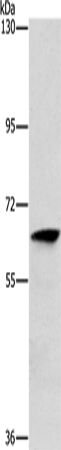 Anti-ALG6 Rabbit Polyclonal Antibody