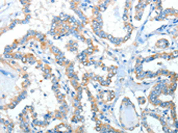 Anti-alpha 1a Adrenergic Receptor Rabbit Polyclonal Antibody