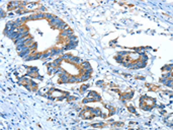 Anti-GLRA1 Rabbit Polyclonal Antibody