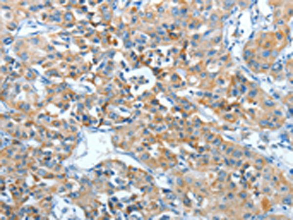 Anti-ADRA1B Rabbit Polyclonal Antibody