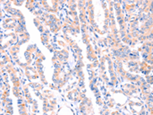 Anti-AMPD1 Rabbit Polyclonal Antibody