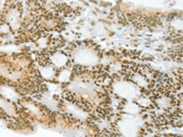 Anti-Angiopoietin 4 Rabbit Polyclonal Antibody