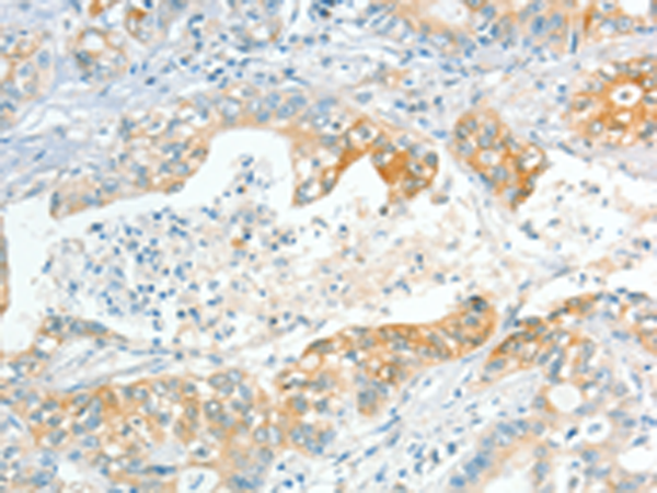 Anti-ApoL2 Rabbit Polyclonal Antibody