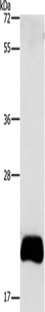 Anti-ApoBEC3C Rabbit Polyclonal Antibody