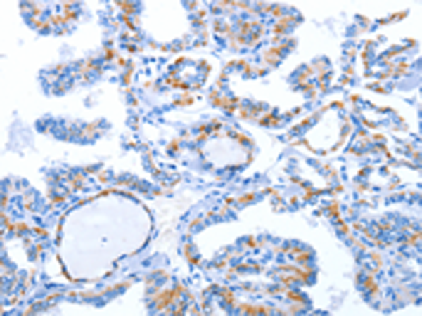 Anti-Wnt1 Rabbit Polyclonal Antibody