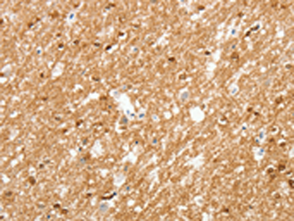 Anti-AMZ1 Rabbit Polyclonal Antibody