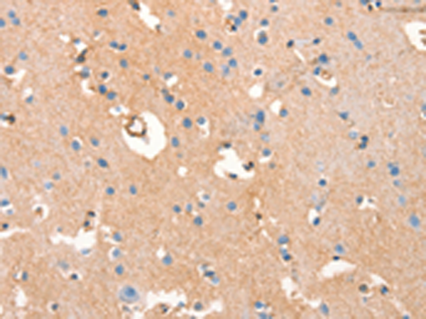 Anti-ARFGEF2 Rabbit Polyclonal Antibody