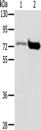 Anti-PIAS1 Rabbit Polyclonal Antibody