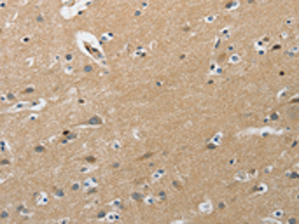 Anti-PIP5K1C Rabbit Polyclonal Antibody