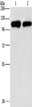 Anti-PIP5K1C Rabbit Polyclonal Antibody