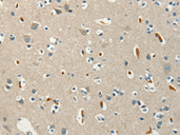 Anti-GCET1 Rabbit Polyclonal Antibody