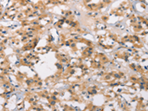 Anti-MTARC1 Rabbit Polyclonal Antibody