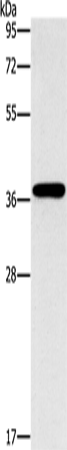 Anti-MTARC1 Rabbit Polyclonal Antibody