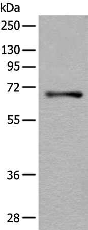 Anti-AK5 Rabbit Polyclonal Antibody
