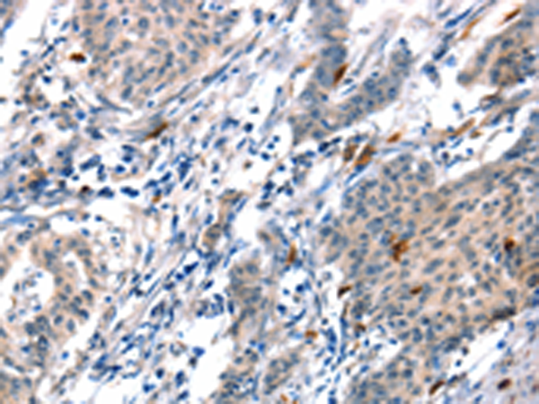 Anti-ADM Rabbit Polyclonal Antibody