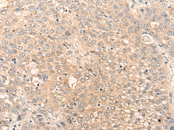 Anti-SLC15A1 Rabbit Polyclonal Antibody