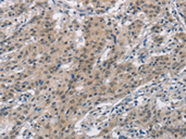 Anti-Smad9 Rabbit Polyclonal Antibody
